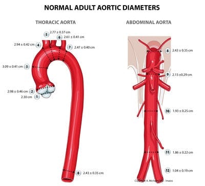 normal-adult-aortic-diameters-en