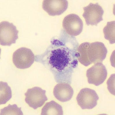 Giant thrombocyte, MGG coloration, cellavision DM1200