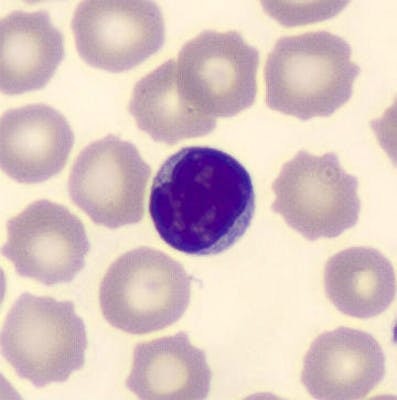 Small lymphocyte, MGG coloration, cellavision DM1200