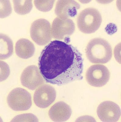 Large lymphocyte, MGG coloration, cellavision DM1200