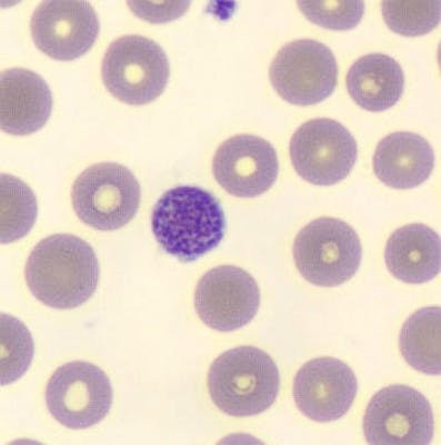 Giant thrombocyte, MGG coloration, cellavision DM1200, x100