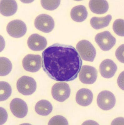 Large lymphocyte, MGG coloration, cellavision DM1200, x100