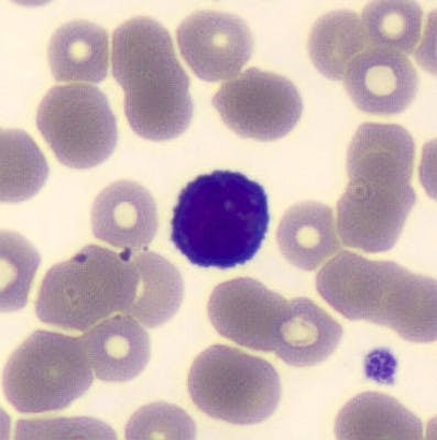 Small lymphocyte, MGG coloration, cellavision DM1200, x100